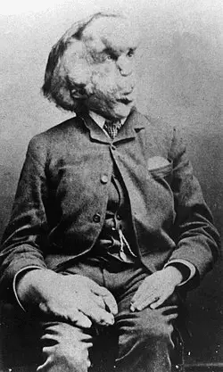 The elephant man torna al cinema in versione 4k