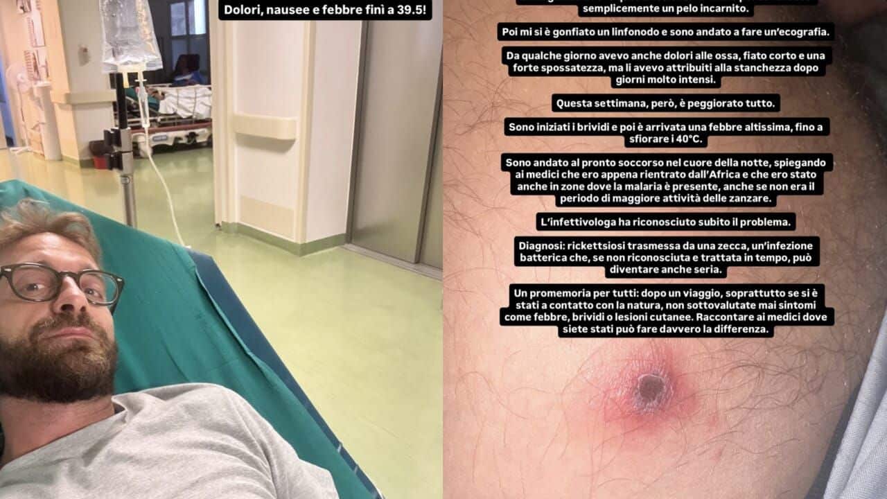 Stefano Corti, ecco come sta dopo la puntura di una zecca