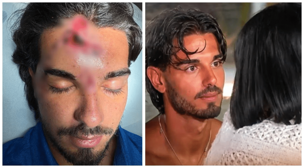 Temptation Island, Marco Fatata dopo l’incidente: come sta Marco Fatata incidente