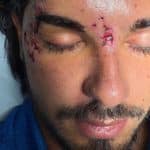 Temptation island, marco fatata dopo l’incidente: come sta
